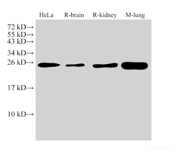 Western Blot analysis of Hela, Rat brain, Rat kidney and Mouse lung using GSTP1 Polyclonal Antibody at dilution of 1:1500