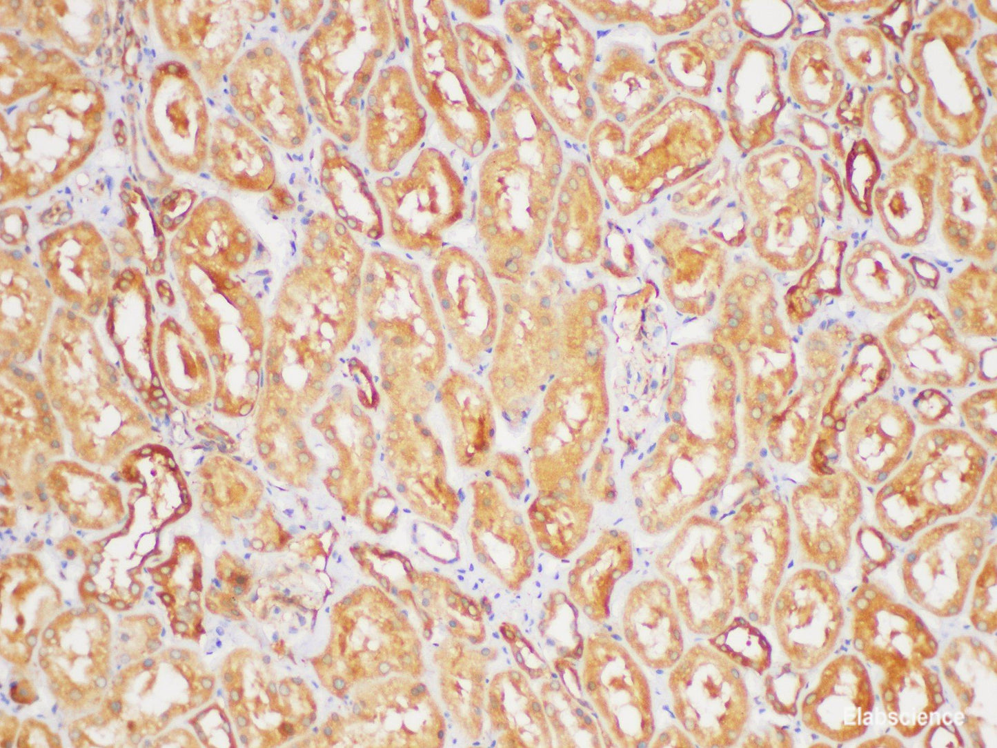 Immunohistochemistry of paraffin-embedded Human kidney using TGFB2 Polycloanl Antibody at dilution of 1:200