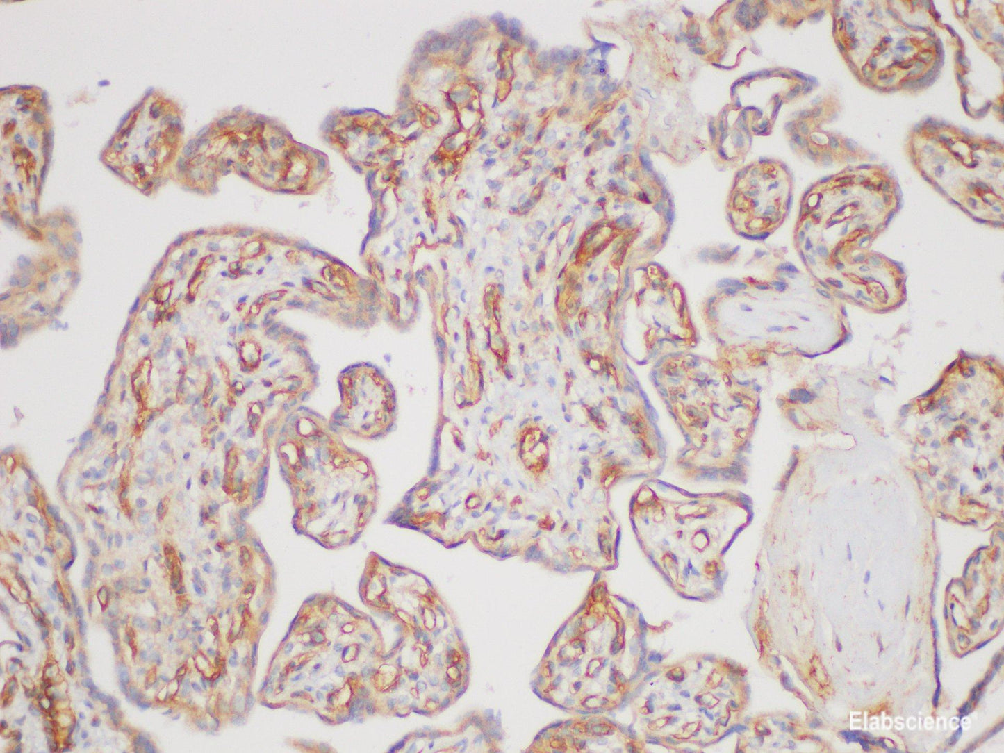 Immunohistochemistry of paraffin-embedded Human placenta using TGFBR2 Polycloanl Antibody at dilution of 1:170