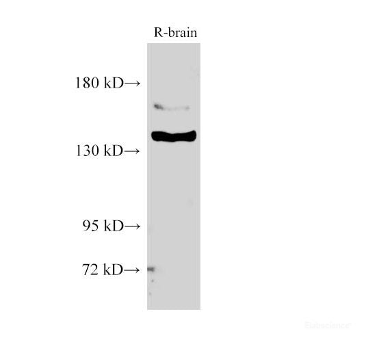 Western Blot analysis of Rat brain using BCR Polyclonal Antibody at dilution of 1:1000