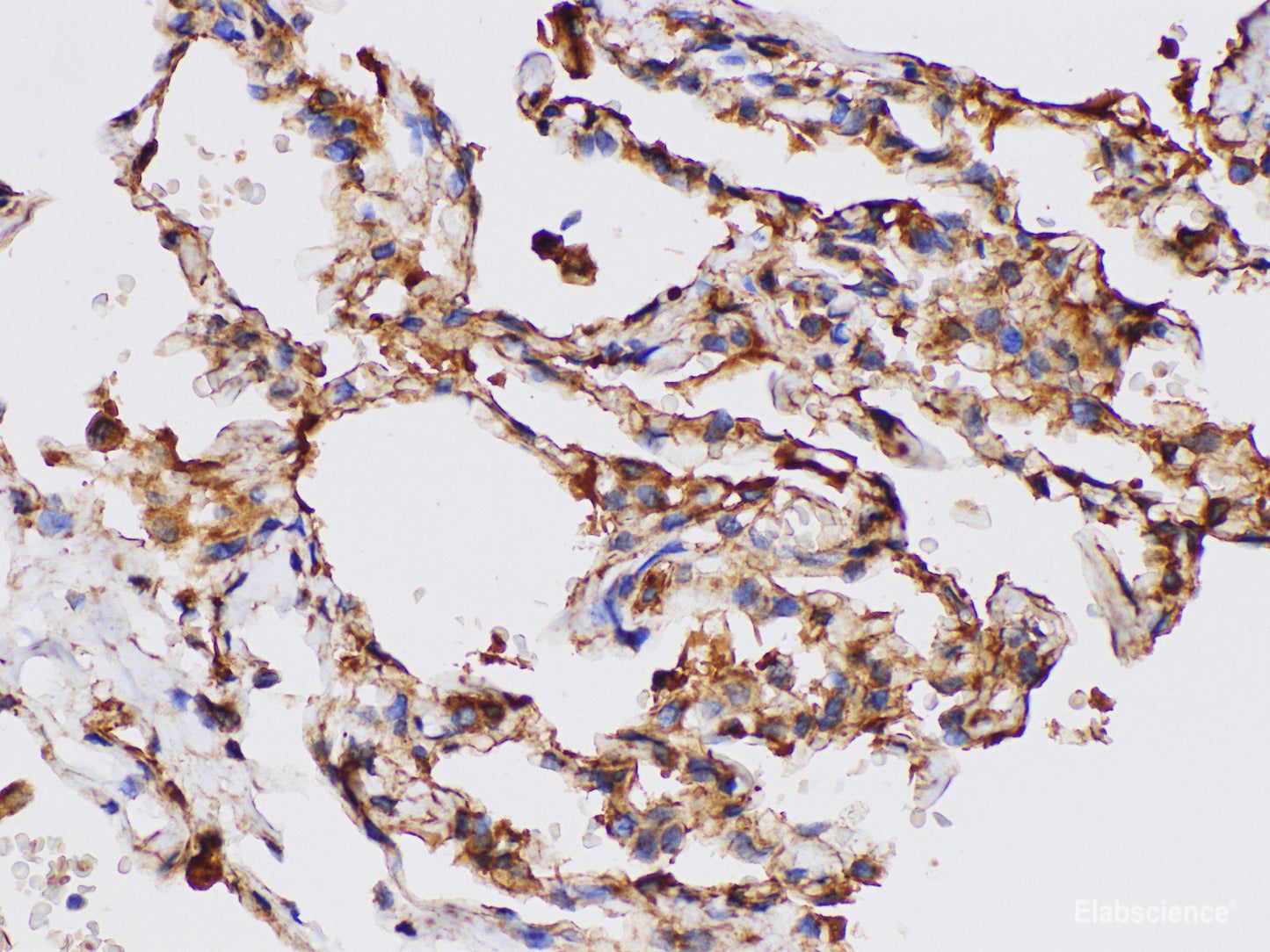 Immunohistochemistry of paraffin-embedded Human lung using FGA Polycloanl Antibody at dilution of 1:100
