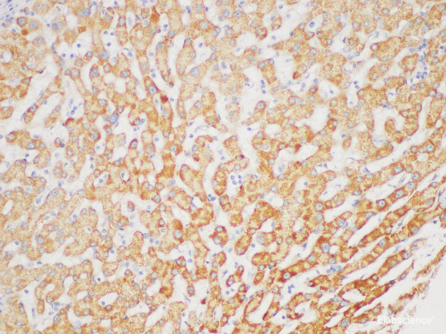 Immunohistochemistry of paraffin-embedded Human liver using FGA Polycloanl Antibody at dilution of 1:200