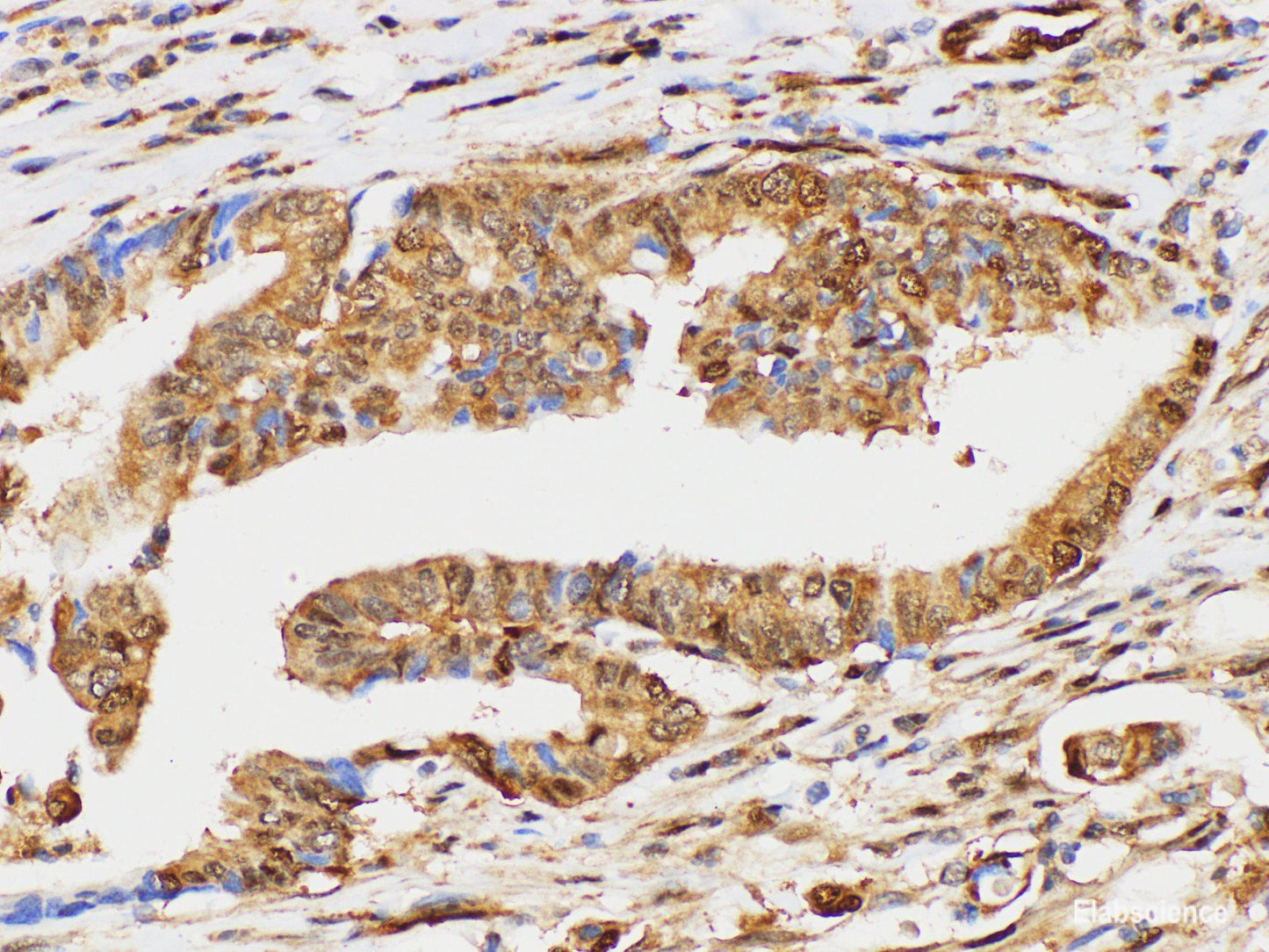 Immunohistochemistry of paraffin-embedded Human duodenum using UBC Polycloanl Antibody at dilution of 1:100