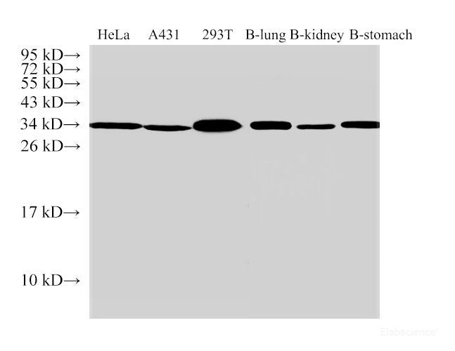 Western Blot analysis of 1)Hela, 2)A431, 3)293T, 4)Bovine lung, 5)Bovine kidney, 6)Bovine stomach using ANXA5 Polyclonal Antibody at dilution of 1:500