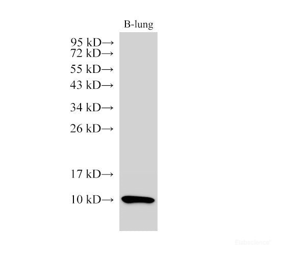 Western Blot analysis of Bovine lung using S100A7 Polyclonal Antibody at dilution of 1:1000
