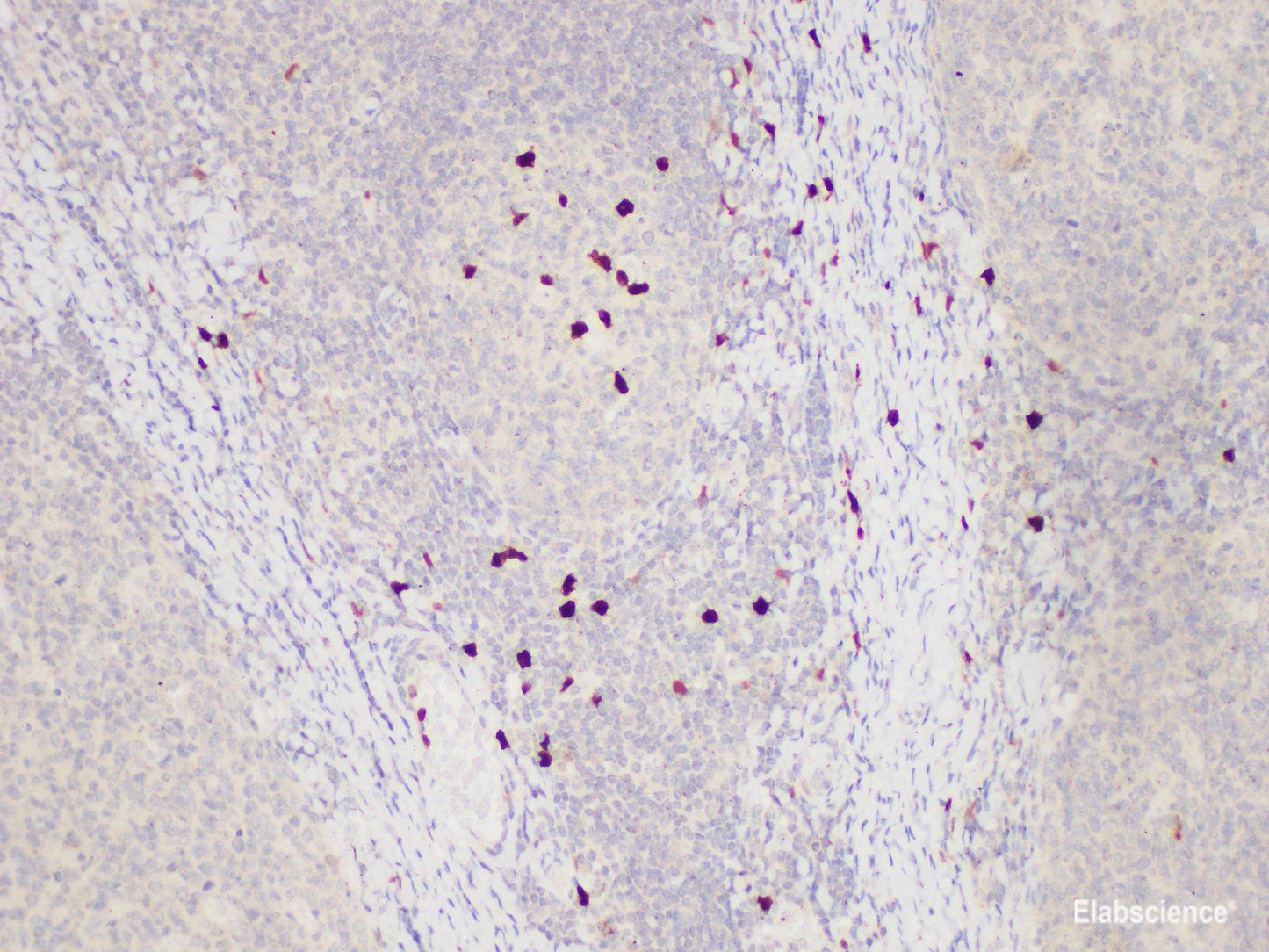 Immunohistochemistry of paraffin-embedded Human tonsil using S100A12 Polycloanl Antibody at dilution of 1:85