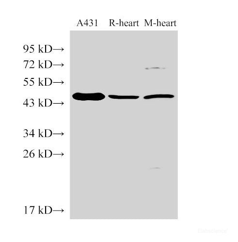Western Blot analysis of 1)A431, 2)Rat heart, 3)Mouse heart using SERPINB2 Polyclonal Antibody at dilution of 1:1000