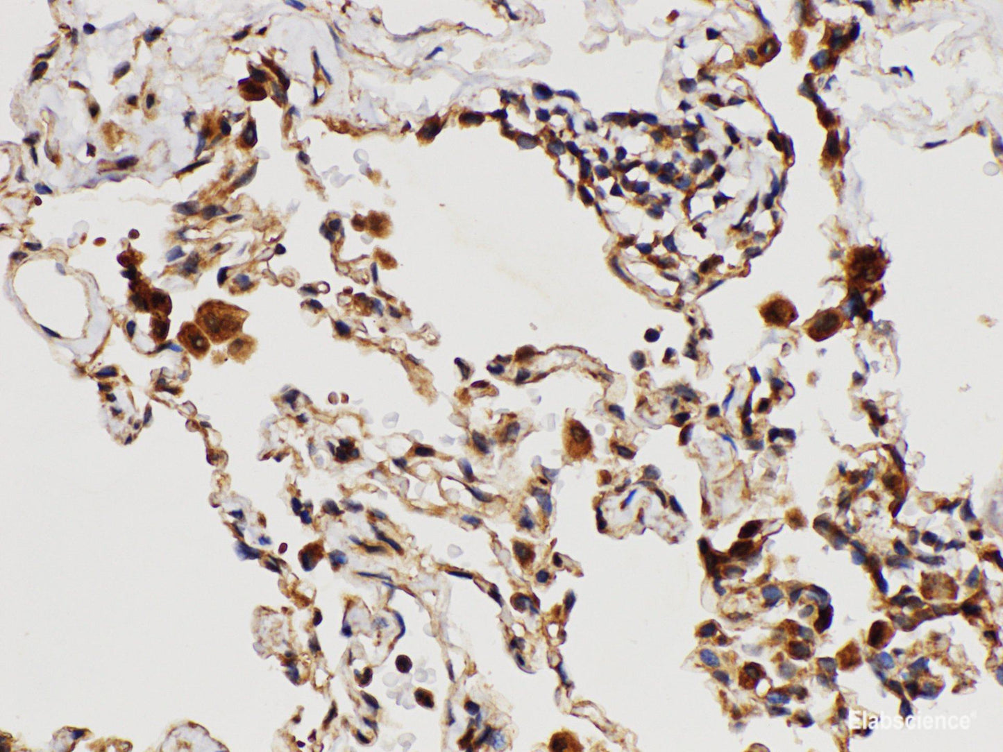 Immunohistochemistry of paraffin-embedded Human lung using IL1RAP Polycloanl Antibody at dilution of 1:150