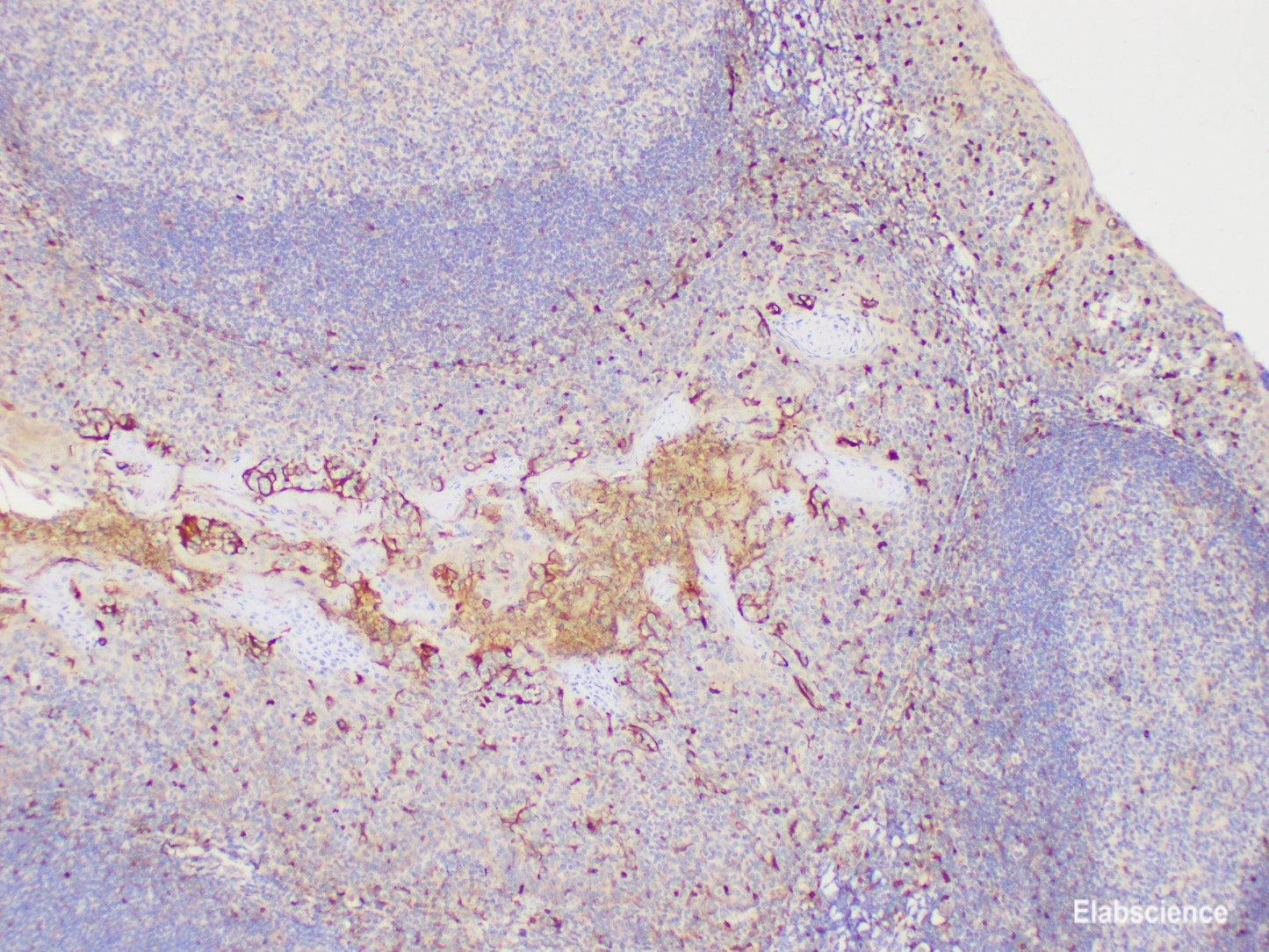 Immunohistochemistry of paraffin-embedded Human tonsil using S100A4 Polycloanl Antibody at dilution of 1:200