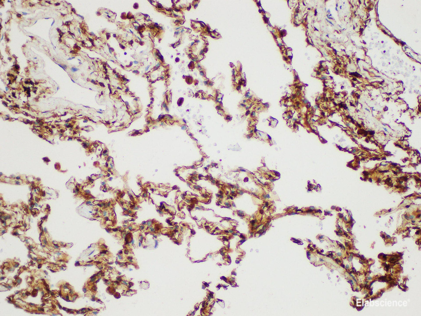 Immunohistochemistry of paraffin-embedded Human lung using S100A4 Polycloanl Antibody at dilution of 1:50
