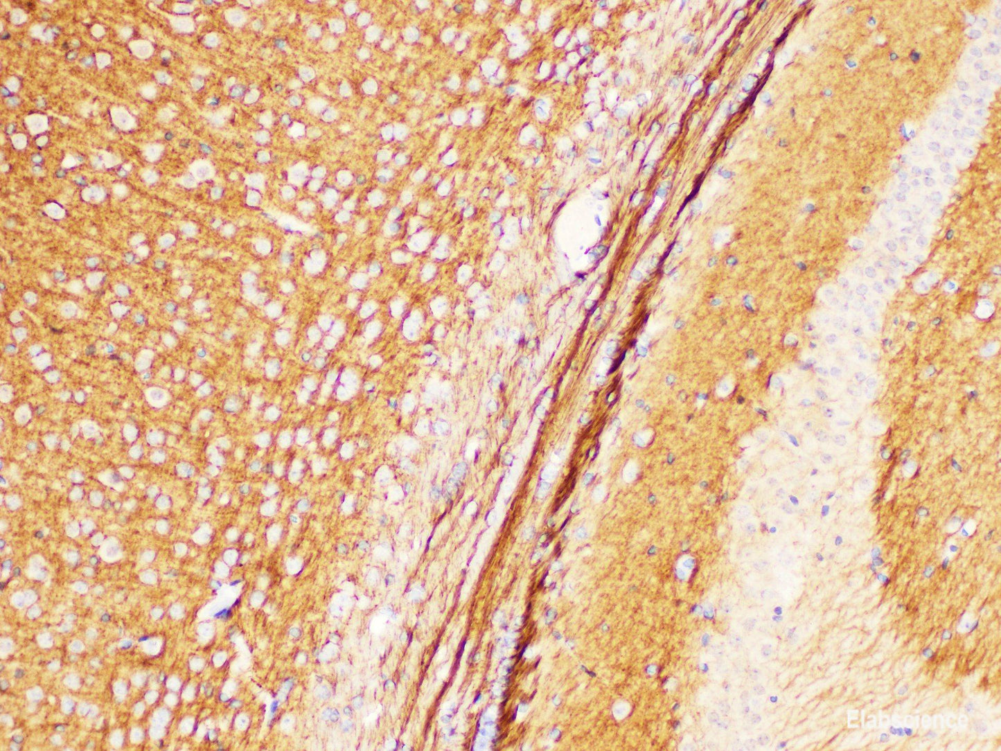 Immunohistochemistry of paraffin-embedded Mouse brain using L1CAM Polycloanl Antibody at dilution of 1:300