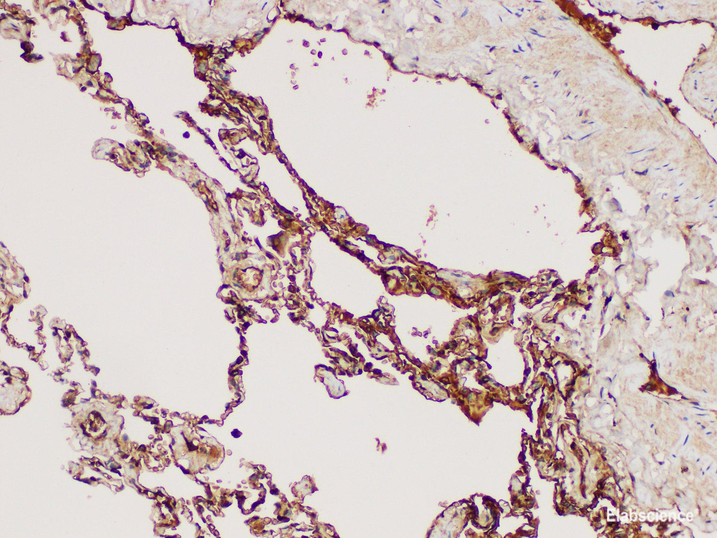 Immunohistochemistry of paraffin-embedded Human lung using DMBT1 Polycloanl Antibody at dilution of 1:300