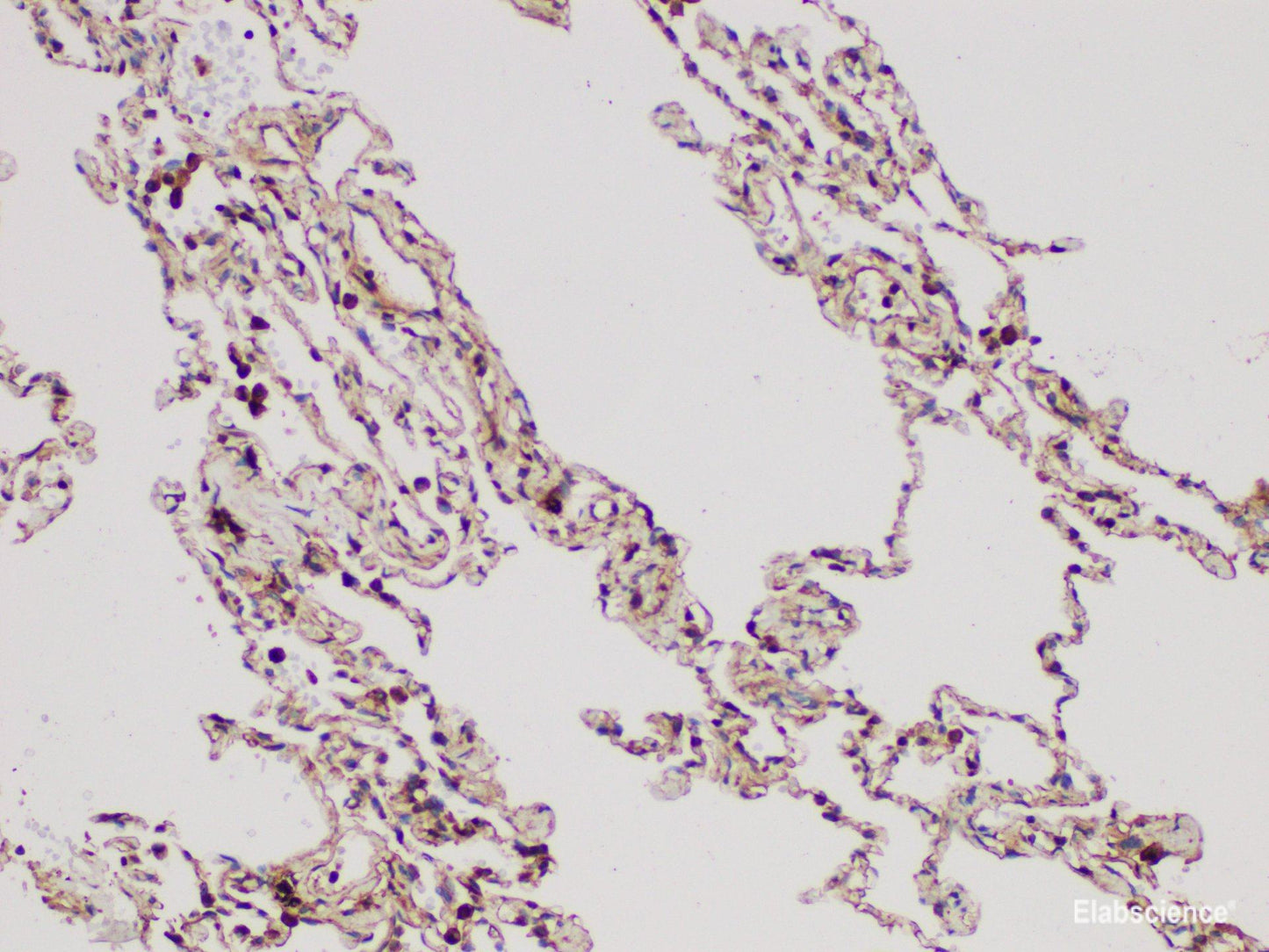 Immunohistochemistry of paraffin-embedded Human lung using DMBT1 Polycloanl Antibody at dilution of 1:300