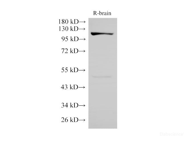 Western Blot analysis of Rat brain using FLT3 Polyclonal Antibody at dilution of 1:3000