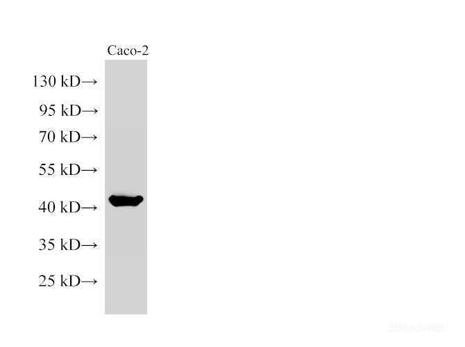 Western Blot analysis of Caco-2 cells using CK19 Polyclonal Antibody at dilution of 1:20000.