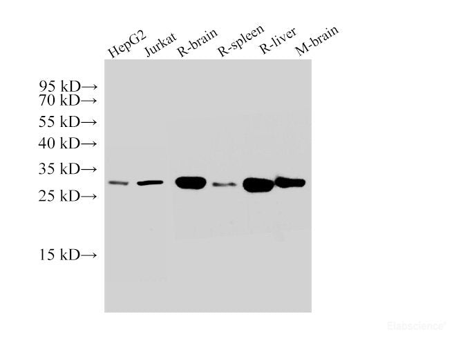 Western Blot analysis of 1)HepG2, 2)Jurkat, 3)Rat brain, 4)Rat spleen, 5)Rat liver, 6)Mouse brain using SDHB Polyclonal Antibody at dilution of 1:50000