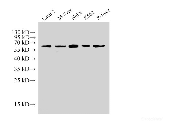 Western Blot analysis of 1)Caco-2, 2)Mouse liver, 3)Hela, 4)K562, 5)Rat liver using HSP60 Polyclonal Antibody at dilution of 1:2000