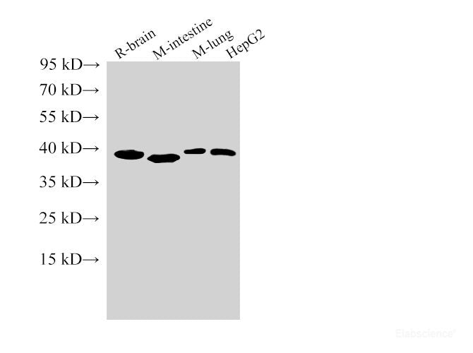 Western Blot analysis of Rat brain, Mouse intestine, Mouse lung and HepG2 cells using TBP Polyclonal Antibody at dilution of 1:5000.