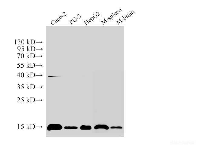 Western Blot analysis of 1)Caco-2, 2)PC-3, 3)HepG2, 4)Mouse Spleen, 5)Mouse brain using Histone H3 Polyclonal Antibody at dilution of 1:250000