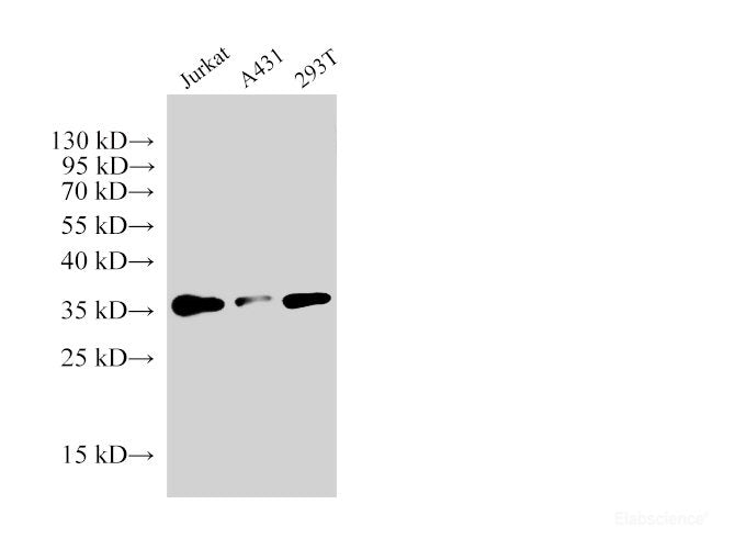 Western Blot analysis of Jurkat, A431 and 293T cells using PCNA Polyclonal Antibody at dilution of 1:6000.
