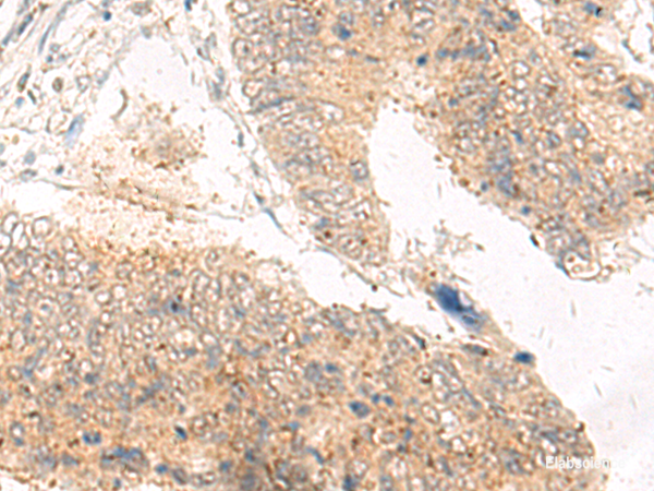 Immunohistochemistry of paraffin-embedded Human tonsil tissue using IDUA Polyclonal Antibody at dilution of 1:30(×200)