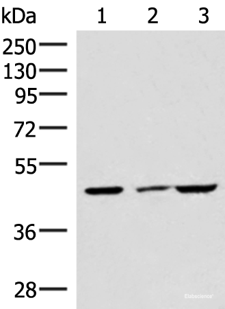 Western blot analysis of HUVEC cell Mouse brain tissue and A549 cell lysates using IP6K2 Polyclonal Antibody at dilution of 1:550