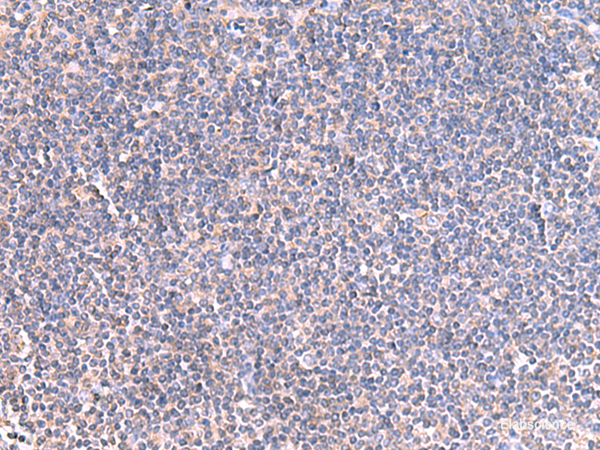 Immunohistochemistry of paraffin-embedded Human tonsil tissue using GRIA2 Polyclonal Antibody at dilution of 1:40(×200)