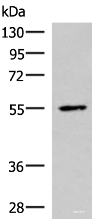 Western blot analysis of HepG2 cell lysate using ISM1 Polyclonal Antibody at dilution of 1:1000