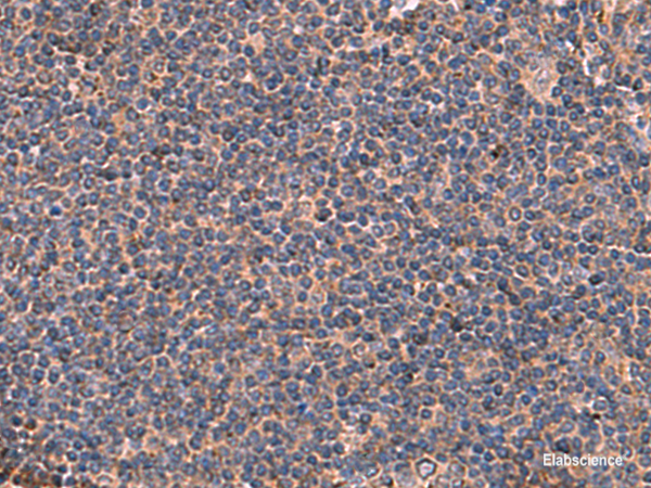 Immunohistochemistry of paraffin-embedded Human tonsil tissue using ITGA11 Polyclonal Antibody at dilution of 1:50(×200)