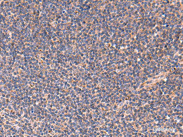 Immunohistochemistry of paraffin-embedded Human tonsil tissue using TNF Polyclonal Antibody at dilution of 1:40(×200)