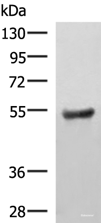 Western blot analysis of Human fetal brain tissue lysate using KDM4D Polyclonal Antibody at dilution of 1:650