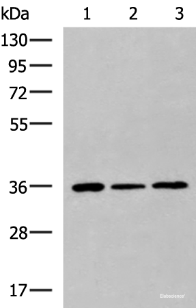 Western blot analysis of HepG2 Hela cell Mouse liver tissue lysates using KHK Polyclonal Antibody at dilution of 1:1000