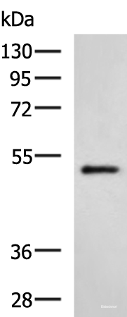 Western blot analysis of Hela cell lysate using HTRA2 Polyclonal Antibody at dilution of 1:500
