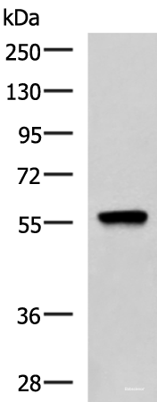 Western blot analysis of A549 cell lysate using TERF1 Polyclonal Antibody at dilution of 1:1000