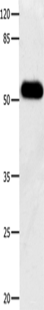 Western blot analysis of Human notum skin cancer tissue using DOK3 Polyclonal Antibody at dilution of 1:500