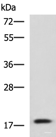 Western blot analysis of Human fetal liver tissue lysate using IL1B Polyclonal Antibody at dilution of 1:800
