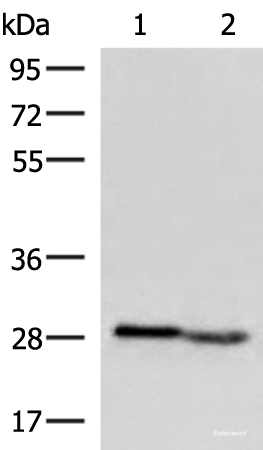 Western blot analysis of Human fetal intestines tissue and Human fetal liver tissue lysates using KLRB1 Polyclonal Antibody at dilution of 1:800