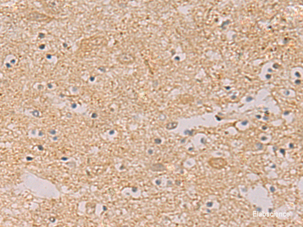 Immunohistochemistry of paraffin-embedded Human brain tissue using PTPRN Polyclonal Antibody at dilution of 1:55(×200)