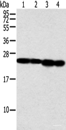 Western blot analysis of Jurkat and A549 cell human fetal liver tissue and hela cell using NDUFB9 Polyclonal Antibody at dilution of 1:350
