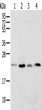 Western blot analysis of Rat lung tissue HT-29 cell Mouse adrenal gland tissue and K-562 cell using SPCS2 Polyclonal Antibody at dilution of 1:450