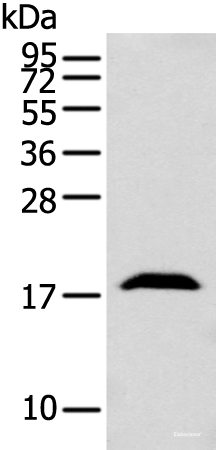 Western blot analysis of Mouse brain tissue using GMFB Polyclonal Antibody at dilution of 1:250