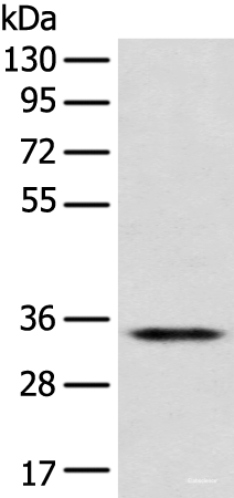 Western blot analysis of Jurkat cell using CD1D Polyclonal Antibody at dilution of 1:300