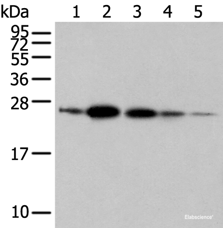 Western blot analysis of 293T A549 and 231 cell Human fetal brain tissue Human placenta tissue using RAB11A Polyclonal Antibody at dilution of 1:500