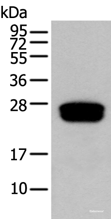 Western blot analysis of Human testis tissue using GLIPR1L1 Polyclonal Antibody at dilution of 1:300