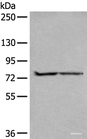 Western blot analysis of A549 and Jurkat cell lysates using ALKBH8 Polyclonal Antibody at dilution of 1:300