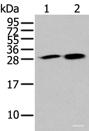 Western blot analysis of 293T and 231 cell lysates using HDHD2 Polyclonal Antibody at dilution of 1:400