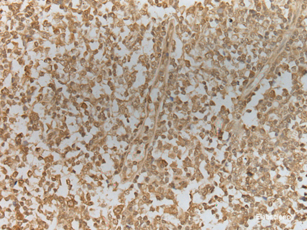 Immunohistochemistry of paraffin-embedded Human tonsil tissue using ZNF8 Polyclonal Antibody at dilution of 1:40(×200)