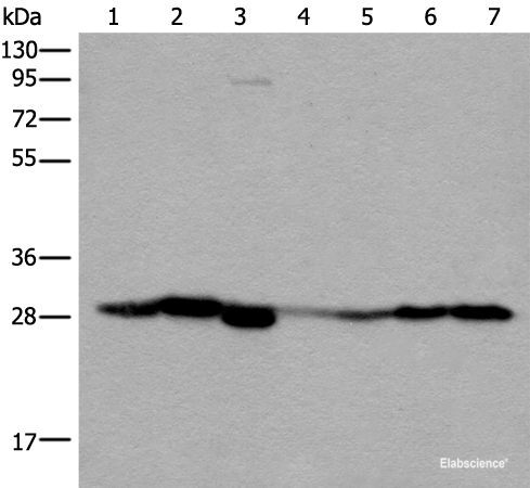 Western blot analysis of Human kidney tissue RAW264.7 cell Mouse kidney tissue Human lung tissue Human fetal liver tissue Hela and 231 cell lysates using VTI1B Polyclonal Antibody at dilution of 1:300