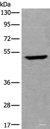 Western blot analysis of Human fetal liver tissue lysate using UMPS Polyclonal Antibody at dilution of 1:400