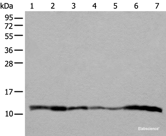 Western blot analysis of 293T A549 Hela and 231 cell Human placenta tissue HEPG2 cell Human fetal liver tissue lysates using UQCRQ Polyclonal Antibody at dilution of 1:400